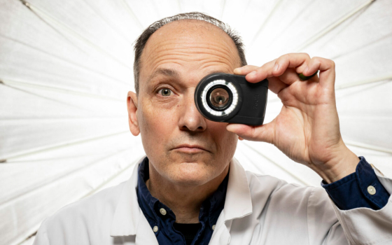 Dr. Joe Stanley looks through a dermoscope — a device used to detect and examine skin cancer. Photo by Michael Pierce/Missouri S&T.